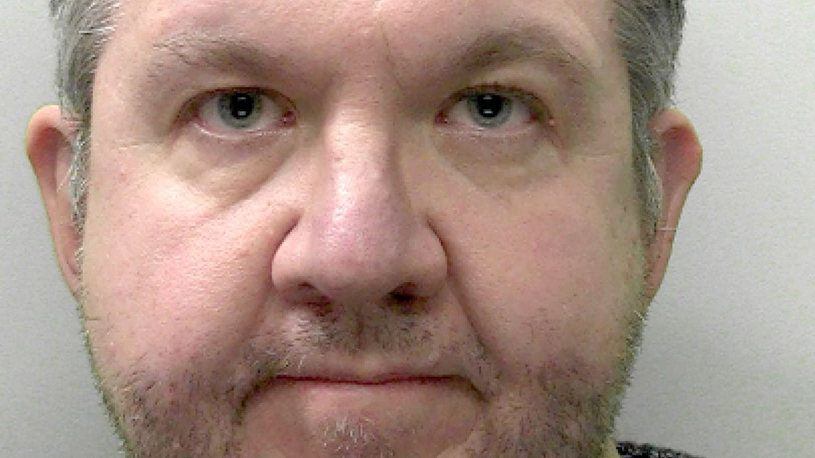 Surgeon's Jail Term:  Fraudulent Amputations Revealed In Court