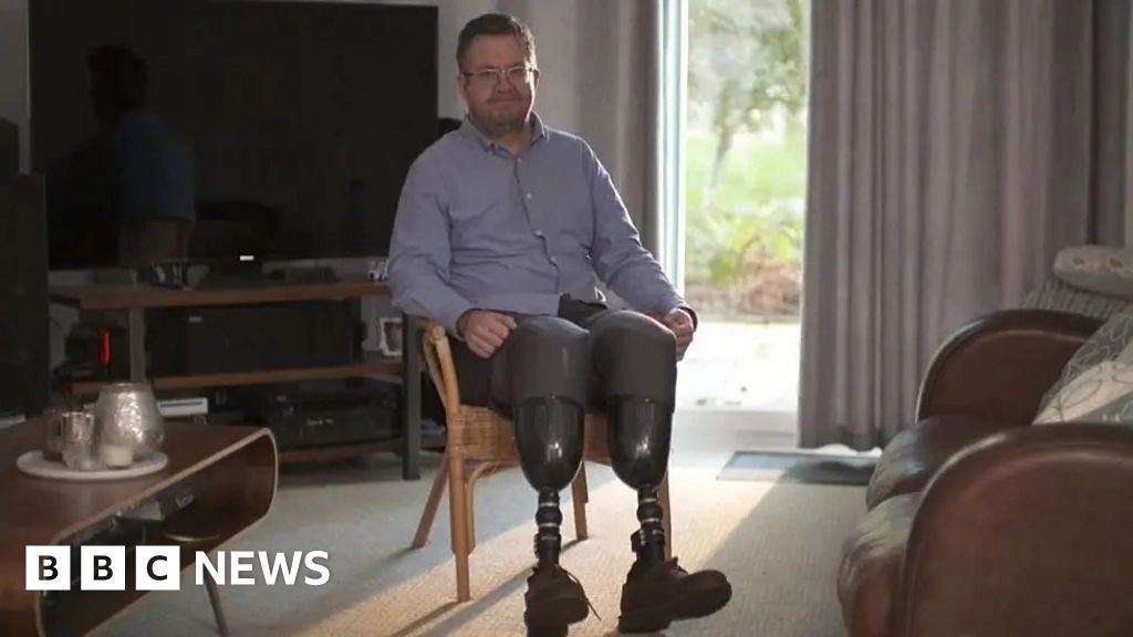 The Conviction Of Surgeon Neil Hopper: A Self-Amputation Story The Conviction Of Surgeon Neil Hopper: A Self-Amputation Story